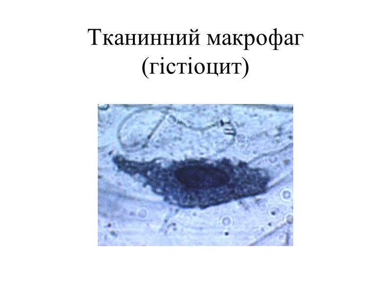 Тканинний макрофаг (гістіоцит)